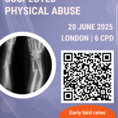 BIR Imaging in Suspected Physical Abuse Course 20th June 2025